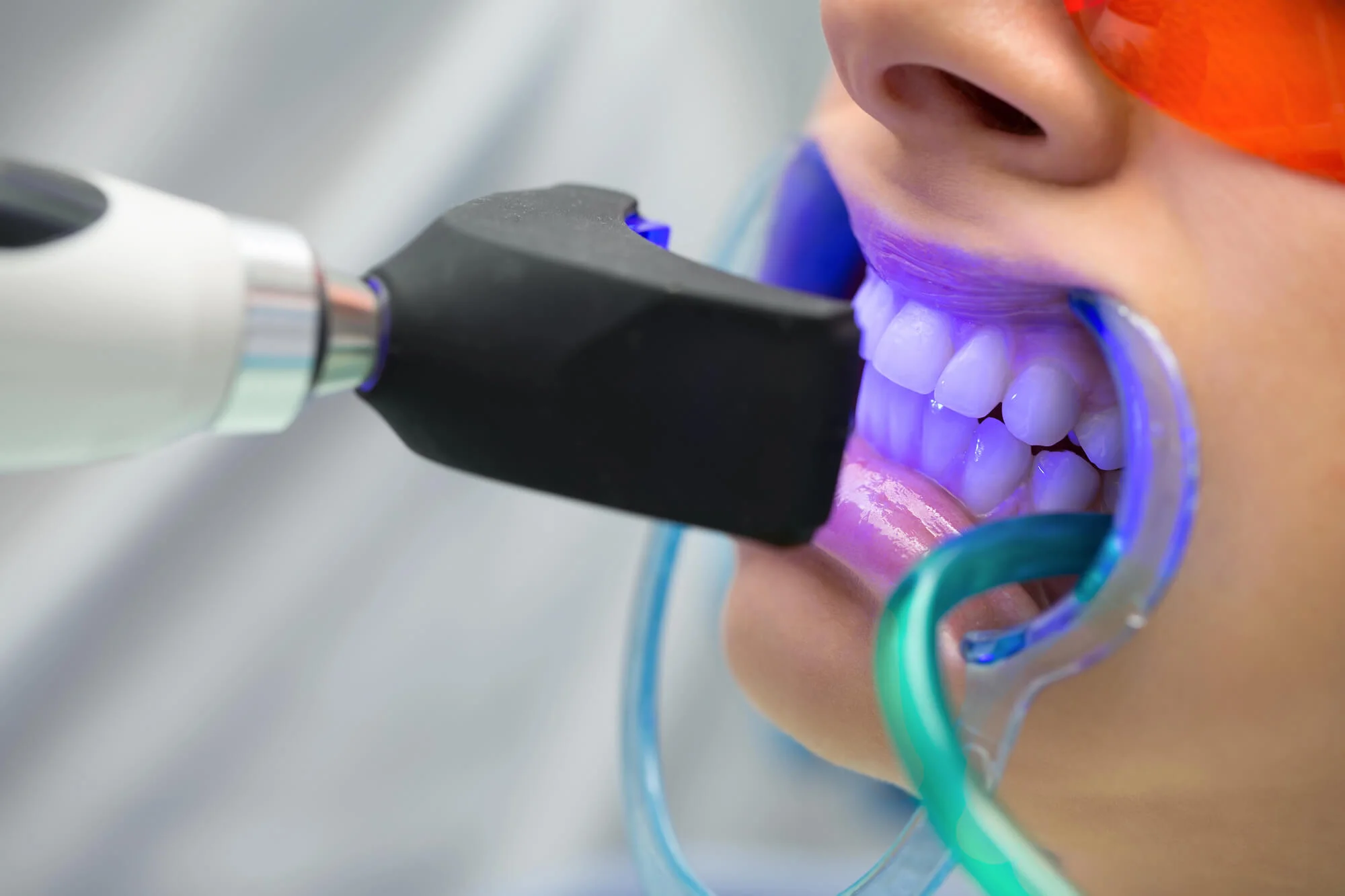 blue light in the teeth whitening