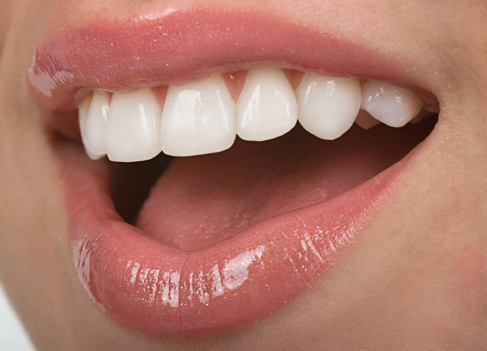 Close-up of healthy white teeth with natural shine and glossy lips, showing results of professional dental care. Teeth whitening in Pembroke Pines
