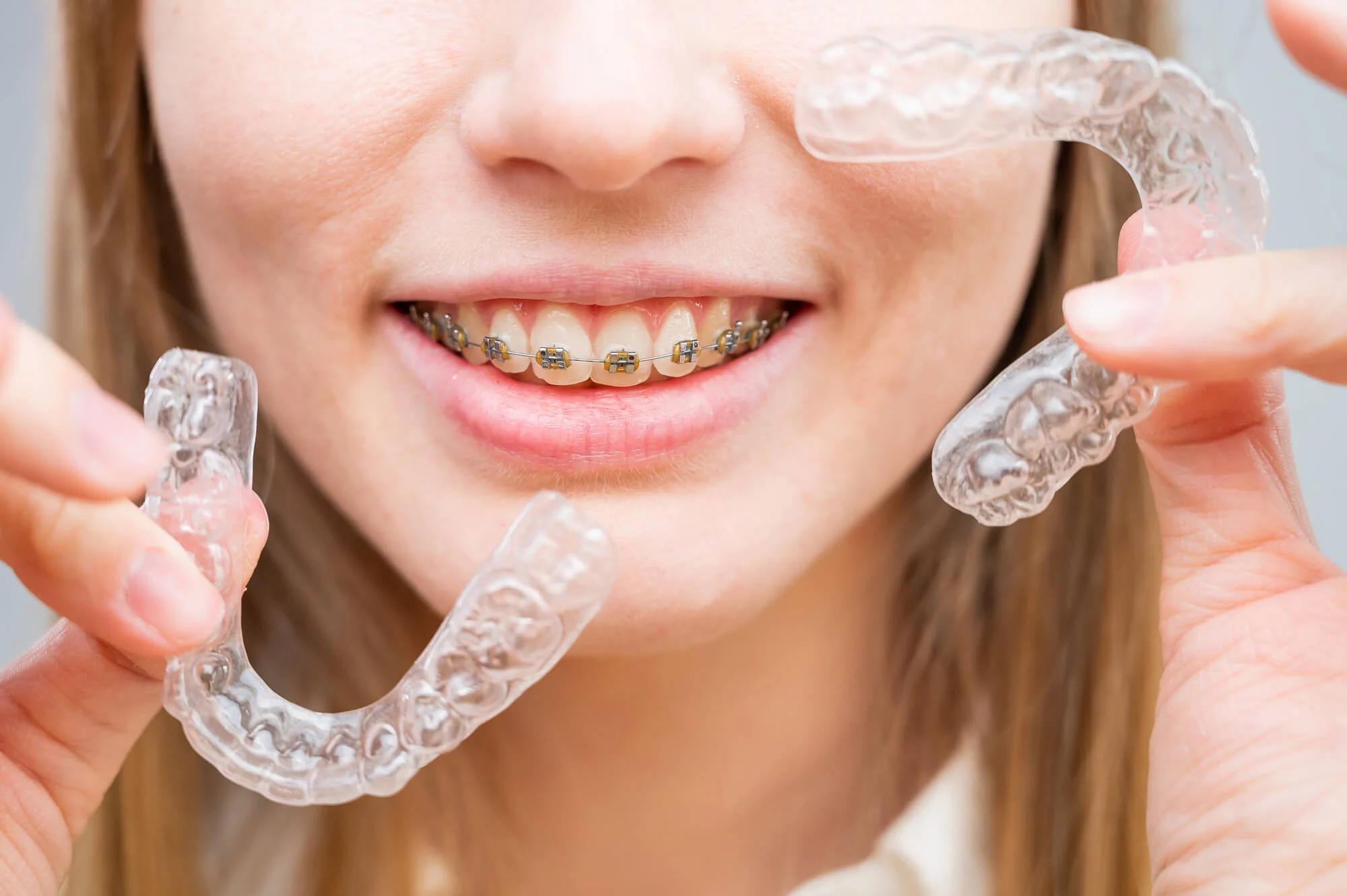Smiling-girl-with-braces-in-Pembroke-Pines-holding-Invisalign