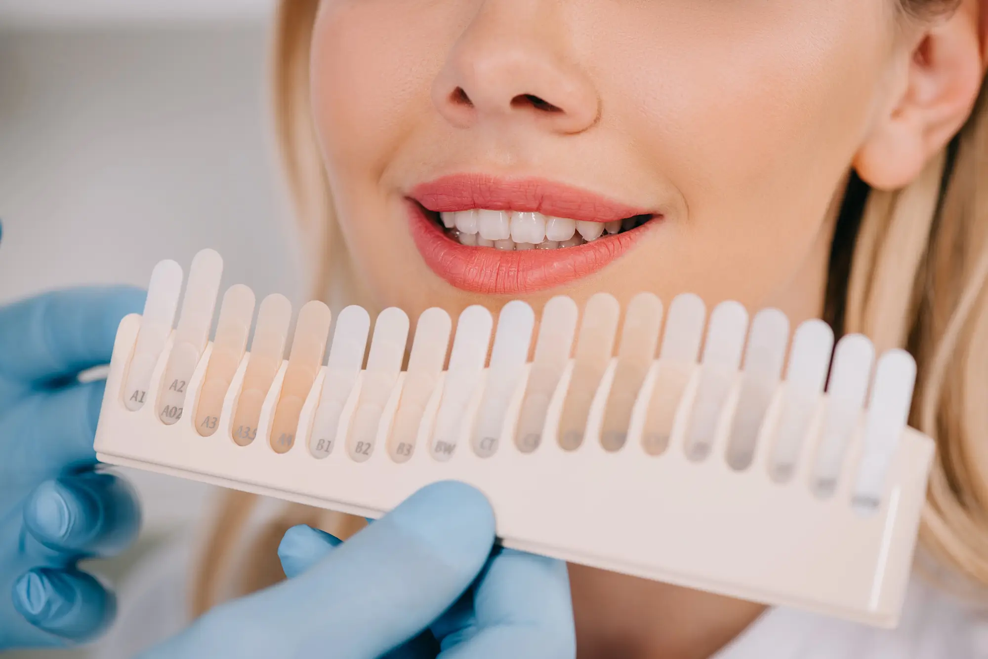 Dentist matching teeth color palette during teeth whitening in Pembroke Pines