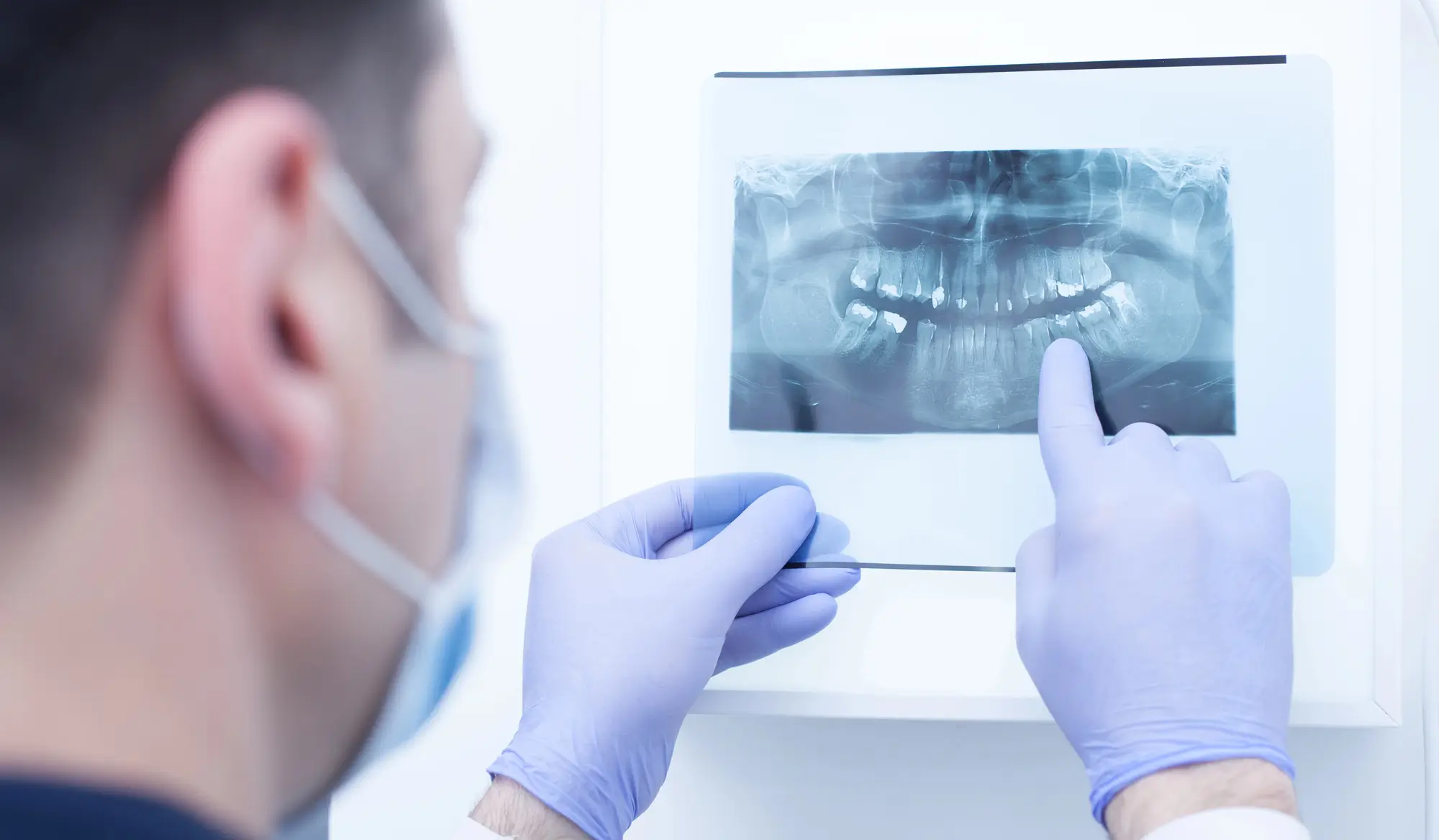 Male doctor looking at dental x-ray, oral surgeon 33026